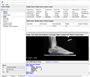 Medical Imaging Suite (DICOM/PACS) SDK by LEADTOOLS